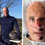 Glenn Campbell before, left, and after his accident